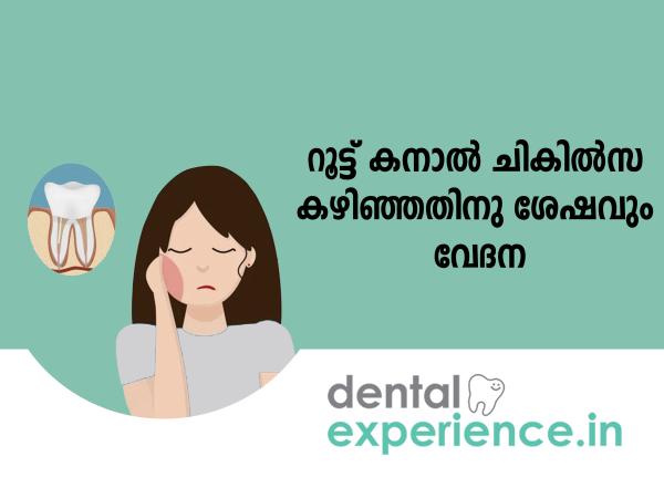 Pain After Root Canal Therapy